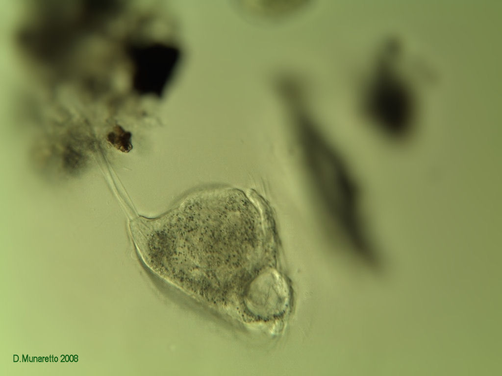 Rieccomi...con Vorticella Gigante a 250x !